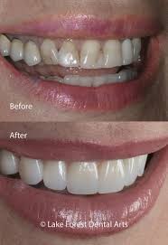 esthetic dentistry