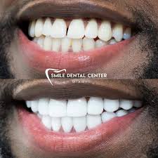 smile dental center