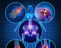 orthopedics