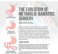 bariatric operation