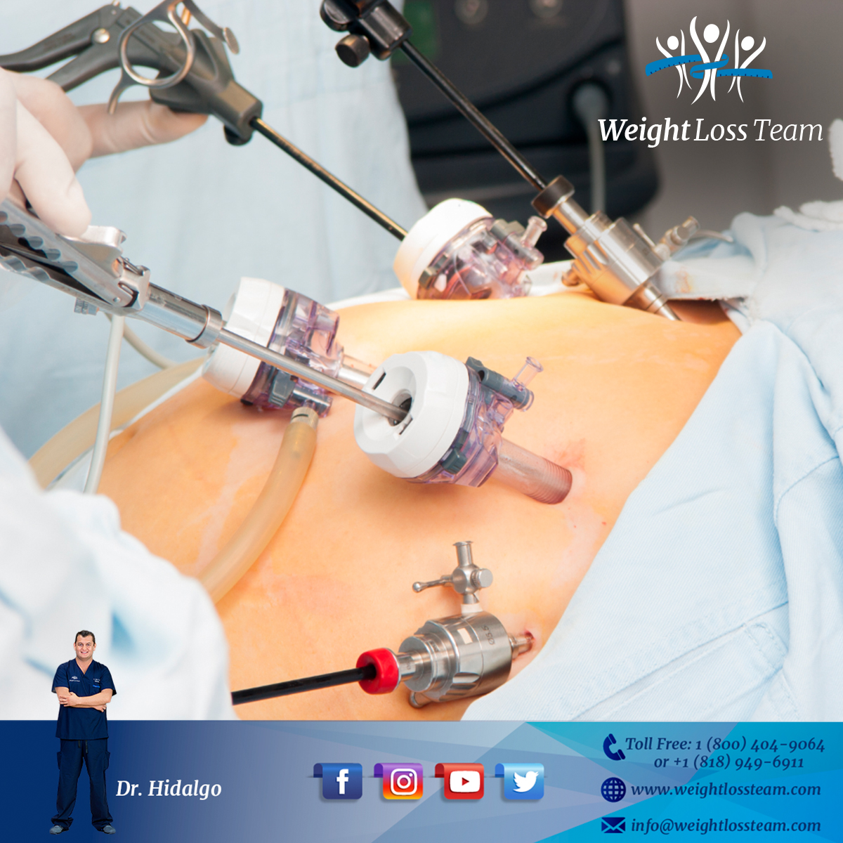 gastric sleeve gastrectomy