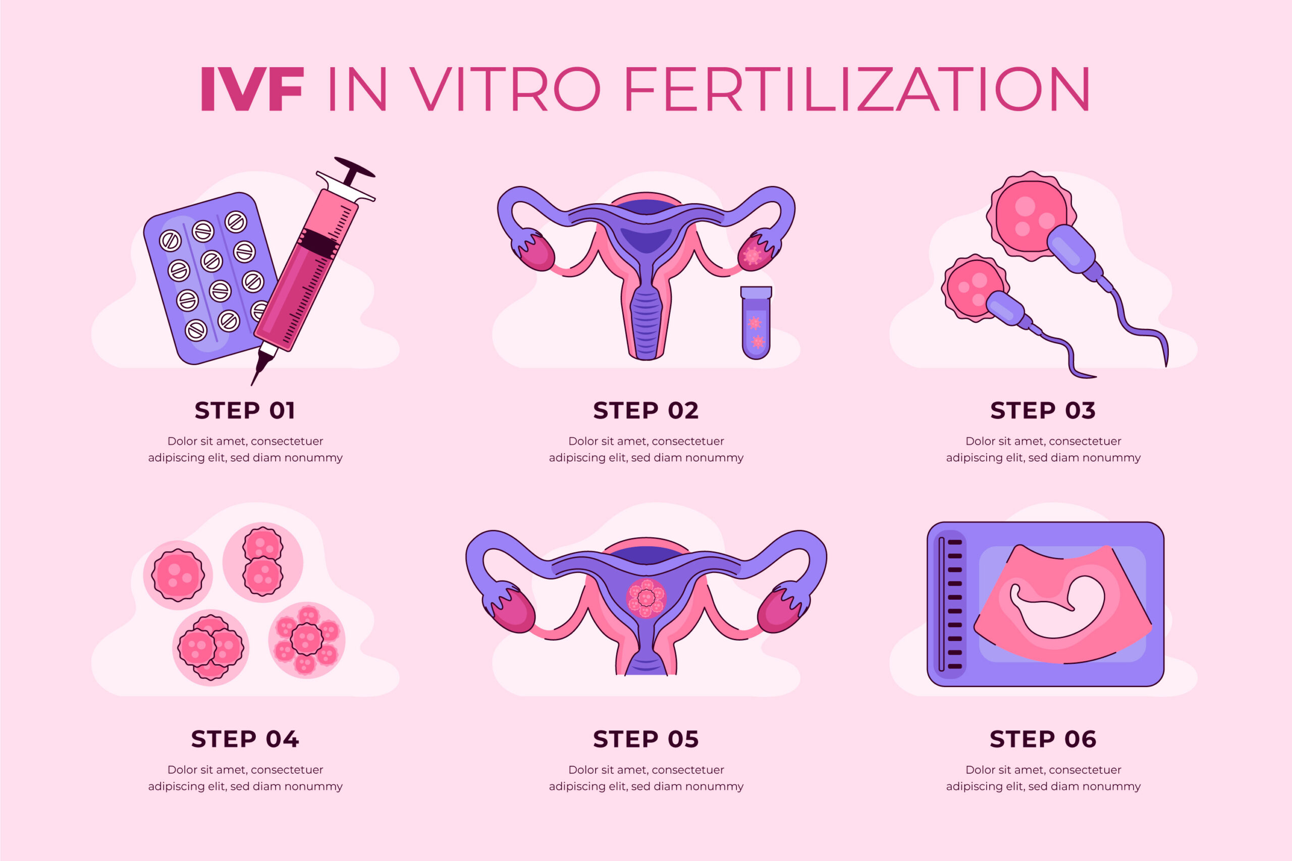 ivf