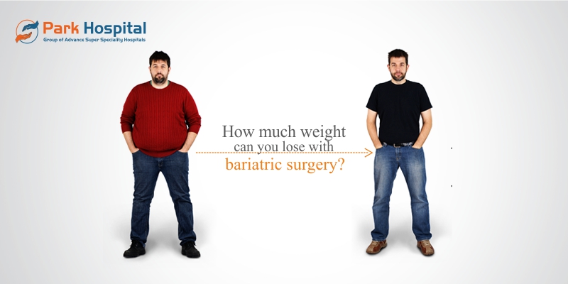 loss weight surgery