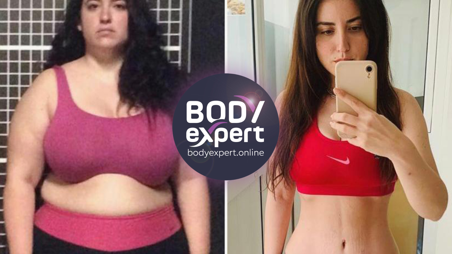 operation to lose weight