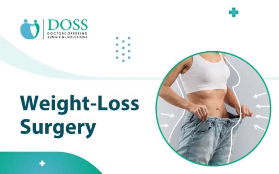 weight loss operation
