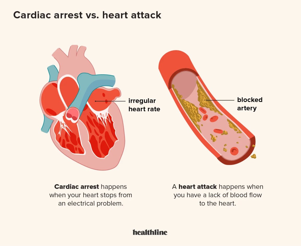 cardiac
