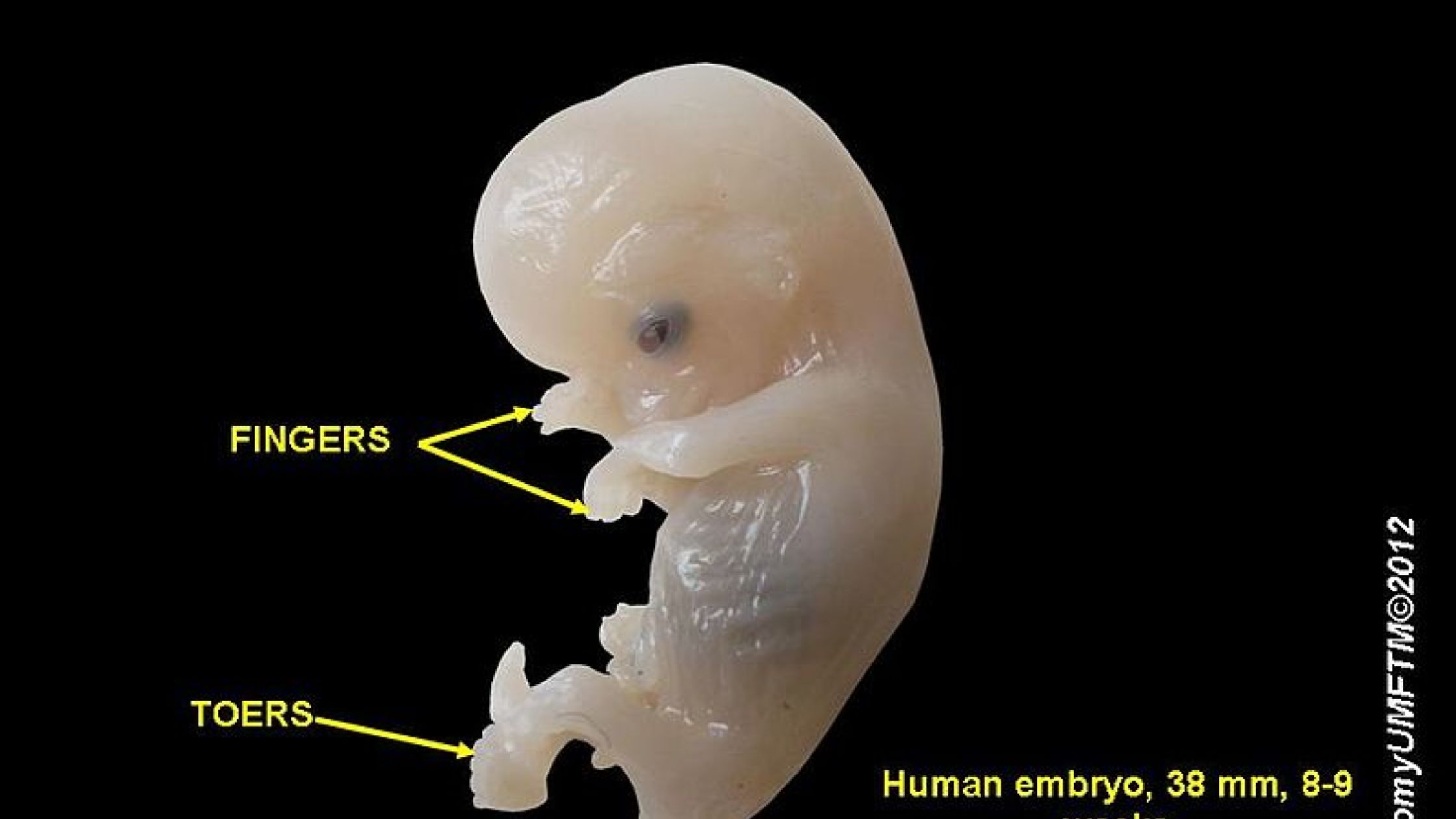 embryo