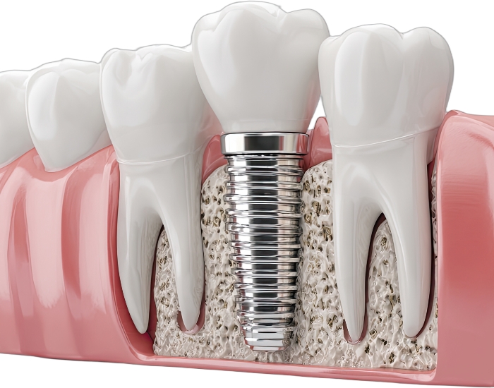 affordable dental