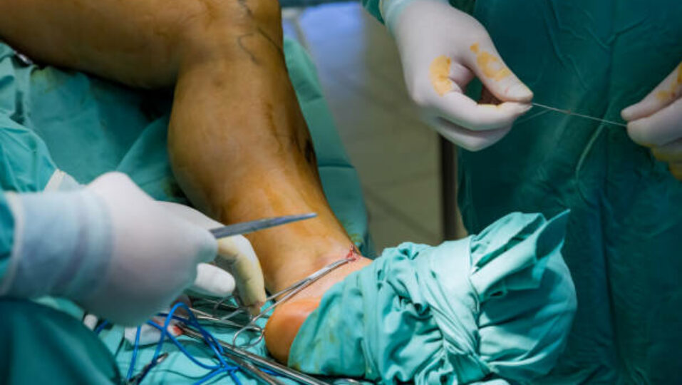 surgical orthopedics